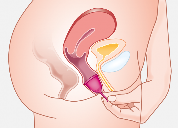 Tulipa Menstruationstasse entfernen