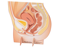 Weibliches Becken / Pelvic Display  - D FEM PELVIS DISPLAY