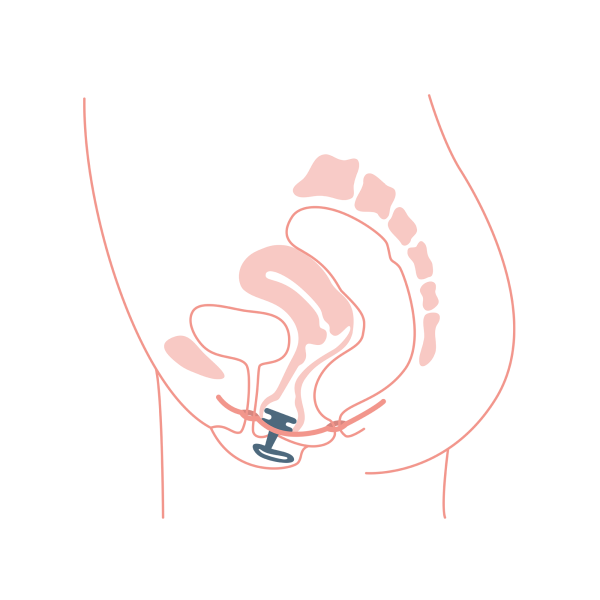 efemia illustration anwendung